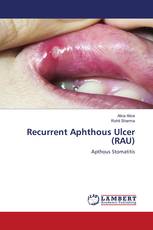 Recurrent Aphthous Ulcer (RAU)