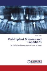 Peri-implant Diseases and Conditions