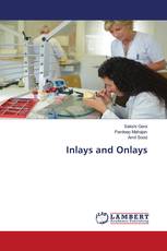 Inlays and Onlays