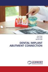 DENTAL IMPLANT ABUTMENT CONNECTION
