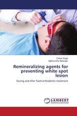 Remineralizing agents for preventing white spot lesion