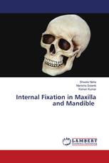 Internal Fixation in Maxilla and Mandible