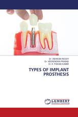 TYPES OF IMPLANT PROSTHESIS