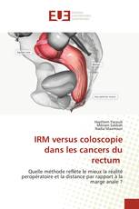 IRM versus coloscopie dans les cancers du rectum