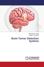 Brain Tumor Detection Systems