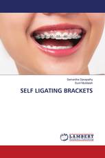 SELF LIGATING BRACKETS