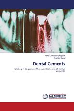 Dental Cements