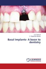 Basal Implants- A boon to dentistry