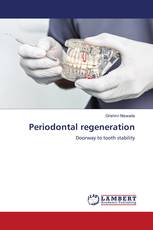 Periodontal regeneration