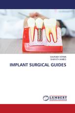 IMPLANT SURGICAL GUIDES