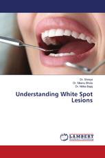 Understanding White Spot Lesions