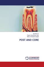 POST AND CORE