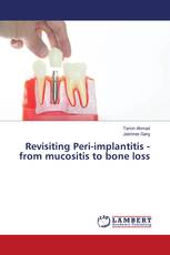 Revisiting Peri-implantitis - from mucositis to bone loss