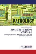 PD-L1 and Hodgkin’s Lymphoma