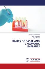 BASICS OF BASAL AND ZYGOMATIC IMPLANTS