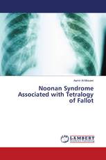 Noonan Syndrome Associated with Tetralogy of Fallot
