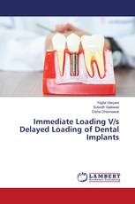 Immediate Loading V/s Delayed Loading of Dental Implants