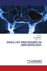 SINUS LIFT PROCEDURES IN IMPLANTOLOGY