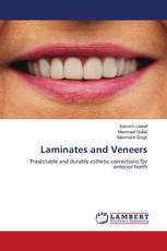 Laminates and Veneers