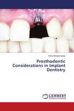 Prosthodontic Considerations in Implant Dentistry