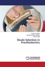 Shade Selection in Prosthodontics