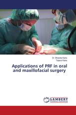 Applications of PRF in oral and maxillofacial surgery