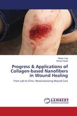 Progress & Applications of Collagen-based Nanofibers in Wound Healing