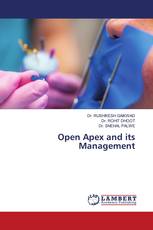 Open Apex and its Management