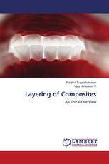 Layering of Composites