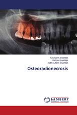 Osteoradionecrosis