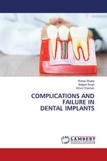 COMPLICATIONS AND FAILURE IN DENTAL IMPLANTS