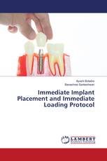 Immediate Implant Placement and Immediate Loading Protocol