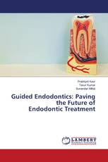 Guided Endodontics: Paving the Future of Endodontic Treatment