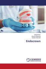 Endocrown