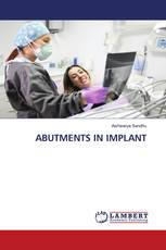 ABUTMENTS IN IMPLANT