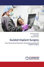 Guided Implant Surgery