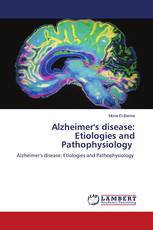 Alzheimer's disease: Etiologies and Pathophysiology