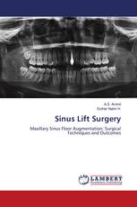 Sinus Lift Surgery