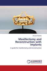 Maxillectomy and Reconstruction with implants