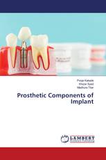 Prosthetic Components of Implant