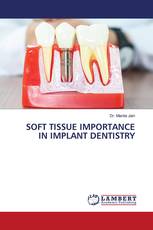 SOFT TISSUE IMPORTANCE IN IMPLANT DENTISTRY