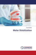 Molar Distalization