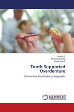 Tooth Supported Overdenture