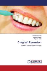 Gingival Recession