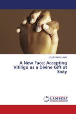 A New Face: Accepting Vitiligo as a Divine Gift at Sixty