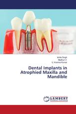 Dental Implants in Atrophied Maxilla and Mandible