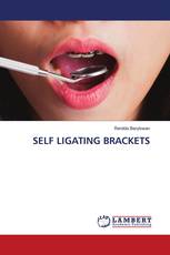 SELF LIGATING BRACKETS