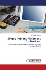 Simple Implant Placement for Novices