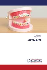 OPEN BITE