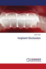 Implant Occlusion